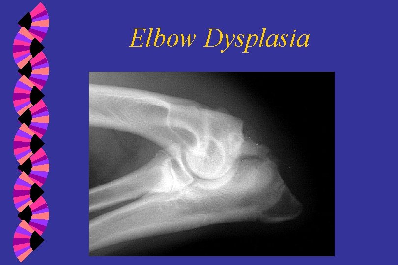 Elbow Dysplasia 