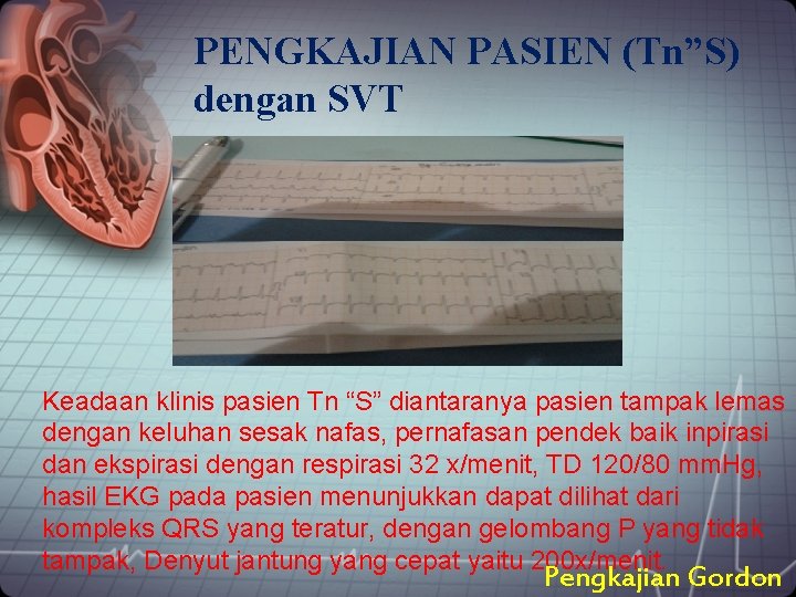 PENGKAJIAN PASIEN (Tn”S) dengan SVT Keadaan klinis pasien Tn “S” diantaranya pasien tampak lemas