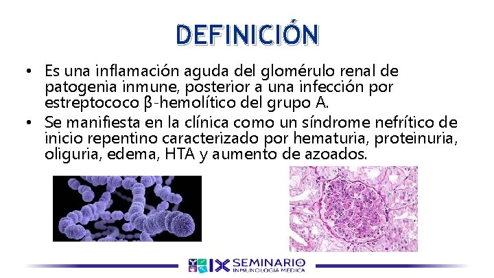 DEFINICIÓN • Es una inflamación aguda del glomérulo renal de patogenia inmune, posterior a