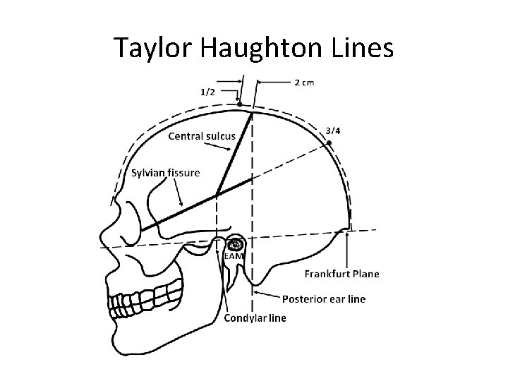 Taylor Haughton Lines 