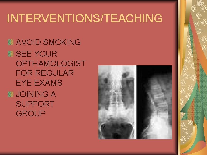 INTERVENTIONS/TEACHING AVOID SMOKING SEE YOUR OPTHAMOLOGIST FOR REGULAR EYE EXAMS JOINING A SUPPORT GROUP