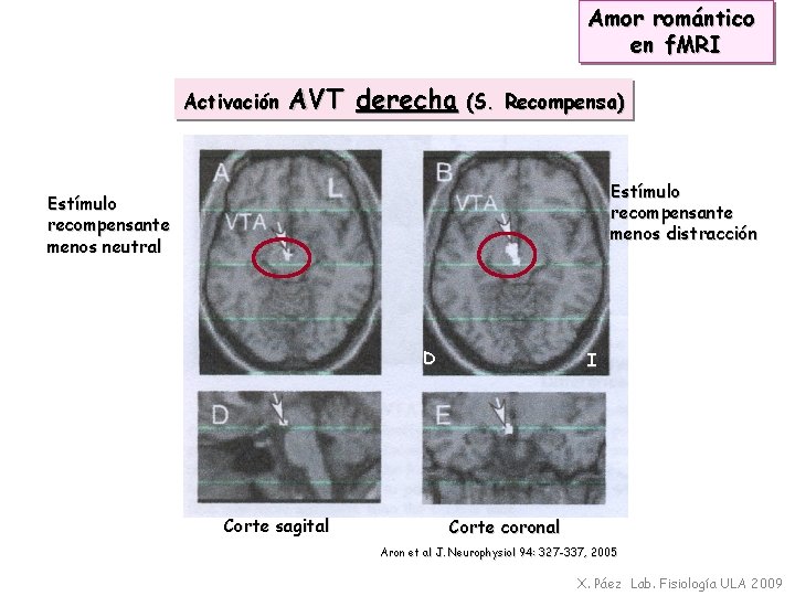 Amor romántico en f. MRI Activación AVT derecha (S. Recompensa) Estímulo recompensante menos distracción