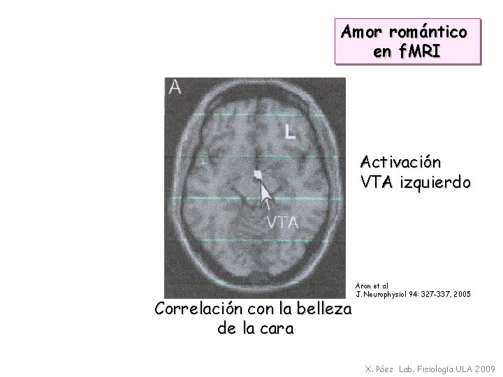 Amor romántico en f. MRI Activación VTA izquierdo Correlación con la belleza de la