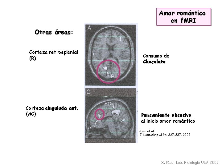 Amor romántico en f. MRI Otras áreas: Corteza retrosplenial (R) Corteza cingulada ant. (AC)