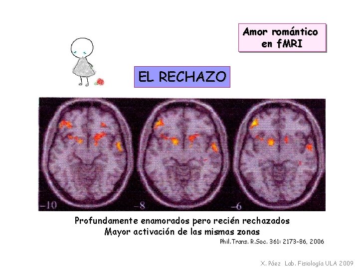 Amor romántico en f. MRI EL RECHAZO Profundamente enamorados pero recién rechazados Mayor activación