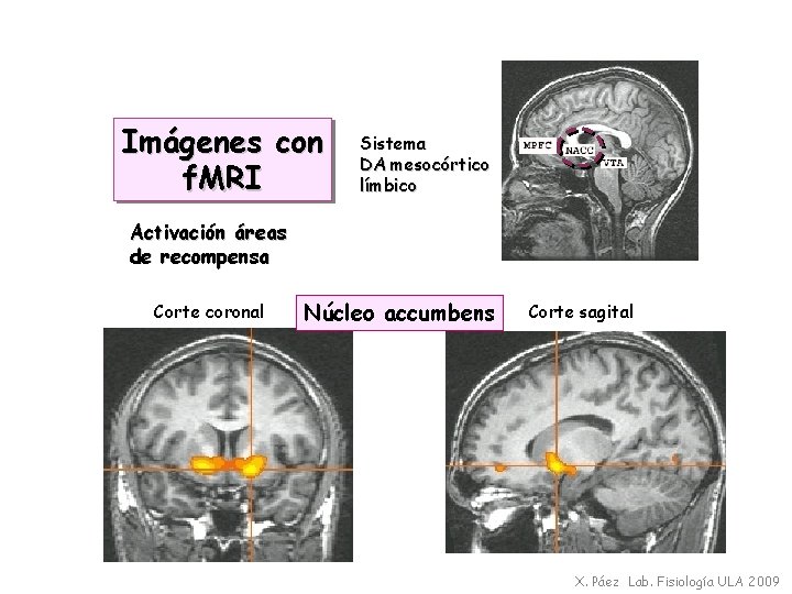 Imágenes con f. MRI Sistema DA mesocórtico límbico Activación áreas de recompensa Corte coronal