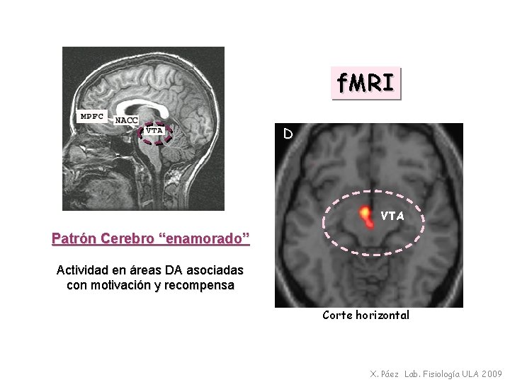 f. MRI D VTA Patrón Cerebro “enamorado” Actividad en áreas DA asociadas con motivación