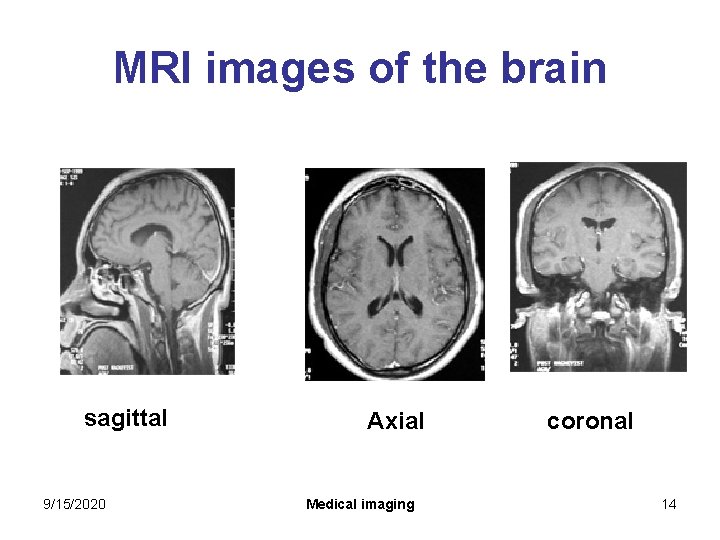 MRI images of the brain sagittal 9/15/2020 Axial Medical imaging coronal 14 MRI images of the brain sagittal 9/15/2020 Axial Medical imaging coronal 14
