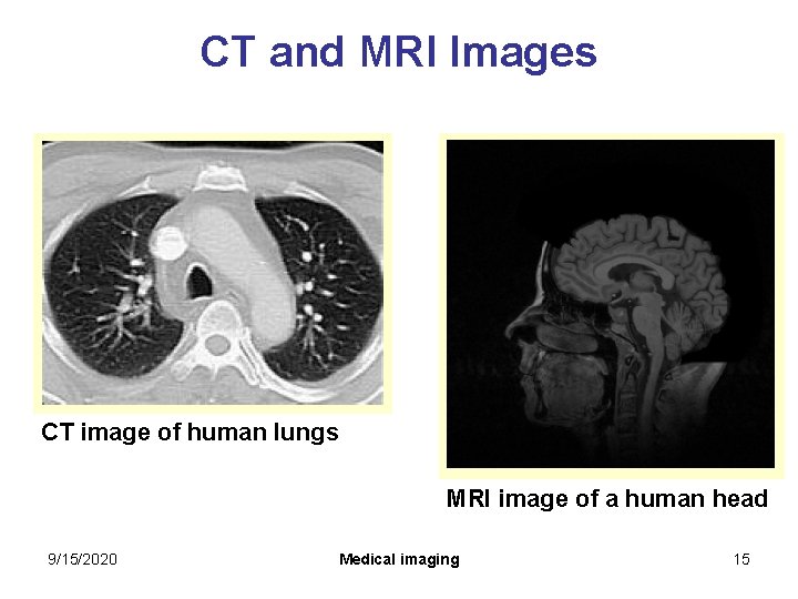 CT and MRI Images CT image of human lungs MRI image of a human CT and MRI Images CT image of human lungs MRI image of a human