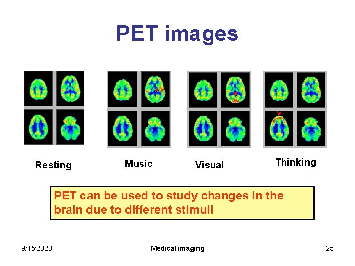 PET images Resting Music Visual Thinking PET can be used to study changes in PET images Resting Music Visual Thinking PET can be used to study changes in