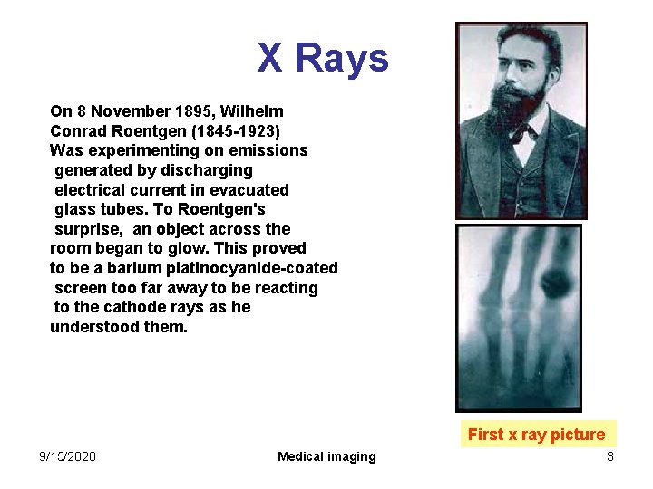 X Rays On 8 November 1895, Wilhelm Conrad Roentgen (1845 -1923) Was experimenting on X Rays On 8 November 1895, Wilhelm Conrad Roentgen (1845 -1923) Was experimenting on