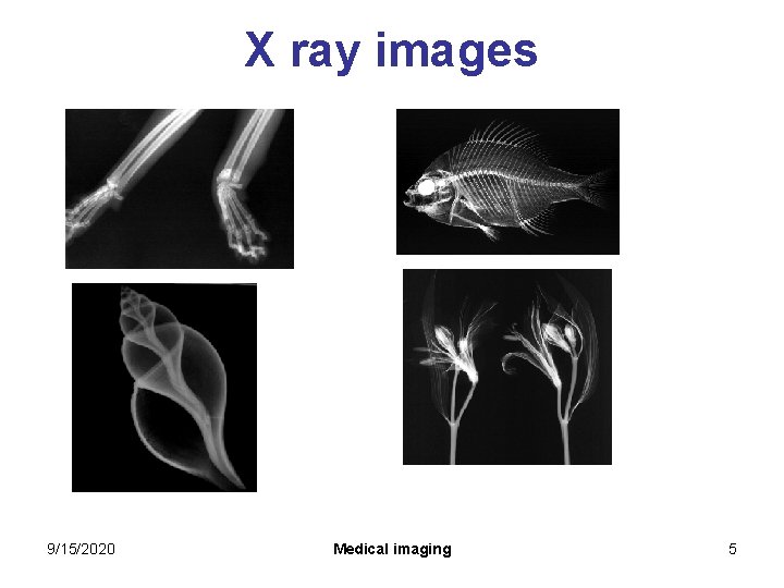 X ray images 9/15/2020 Medical imaging 5 X ray images 9/15/2020 Medical imaging 5