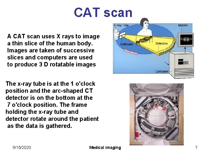 CAT scan A CAT scan uses X rays to image a thin slice of CAT scan A CAT scan uses X rays to image a thin slice of