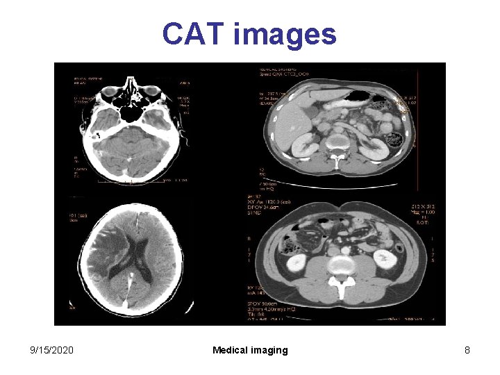 CAT images 9/15/2020 Medical imaging 8 CAT images 9/15/2020 Medical imaging 8