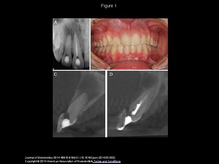 Comparison of Endodontic Diagnosis and Treatment Planning Decisions