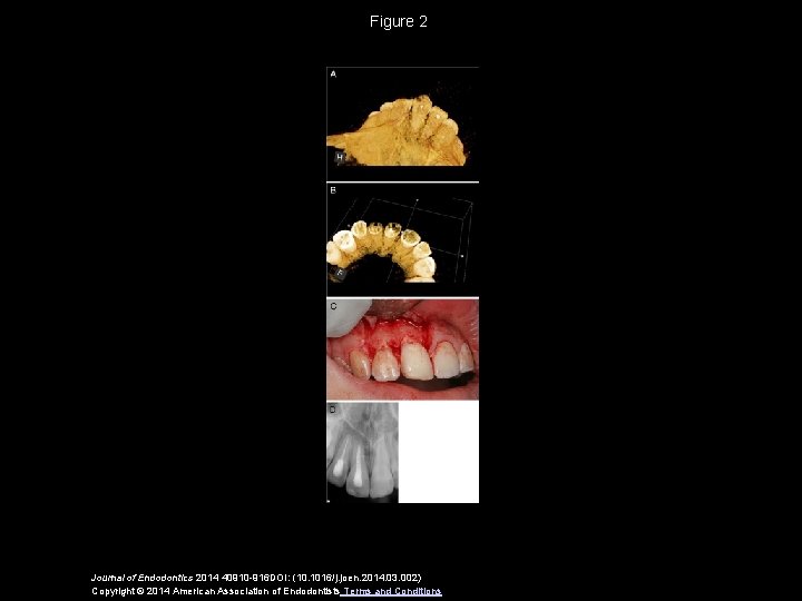 Figure 2 Journal of Endodontics 2014 40910 -916 DOI: (10. 1016/j. joen. 2014. 03.