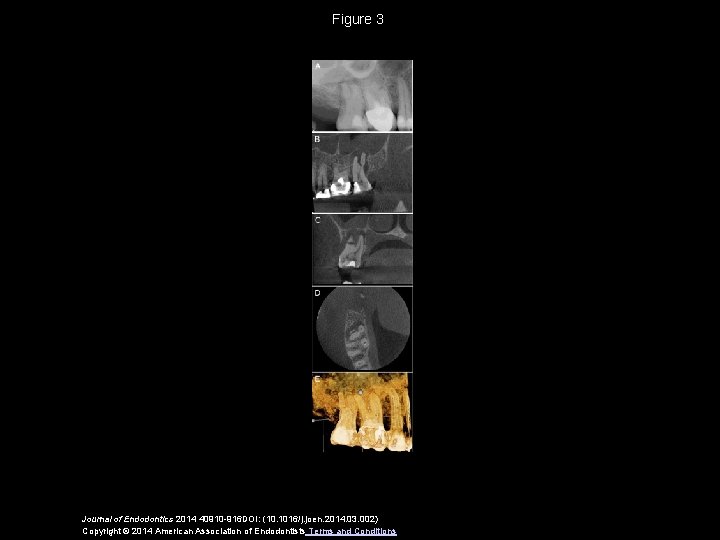 Figure 3 Journal of Endodontics 2014 40910 -916 DOI: (10. 1016/j. joen. 2014. 03.