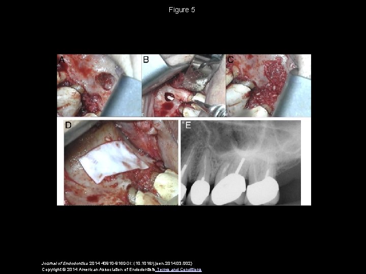 Figure 5 Journal of Endodontics 2014 40910 -916 DOI: (10. 1016/j. joen. 2014. 03.