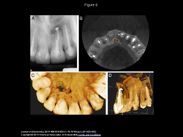 Figure 6 Journal of Endodontics 2014 40910 -916 DOI: (10. 1016/j. joen. 2014. 03.