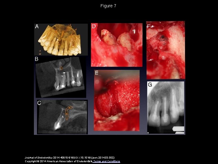 Figure 7 Journal of Endodontics 2014 40910 -916 DOI: (10. 1016/j. joen. 2014. 03.