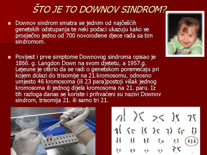 ŠTO JE TO DOWNOV SINDROM? n Downov sindrom smatra se jednim od najčešćih genetskih