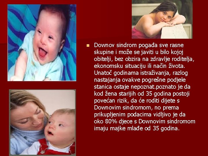 n Downov sindrom pogađa sve rasne skupine i može se javiti u bilo kojoj