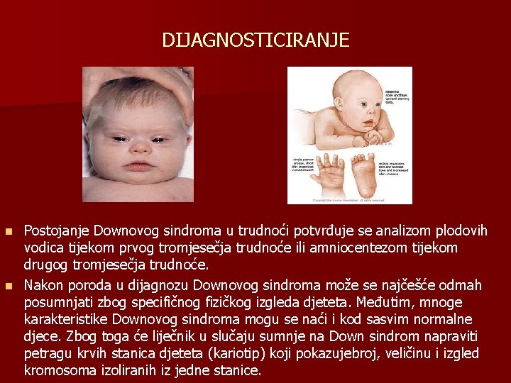 DIJAGNOSTICIRANJE Postojanje Downovog sindroma u trudnoći potvrđuje se analizom plodovih vodica tijekom prvog tromjesečja