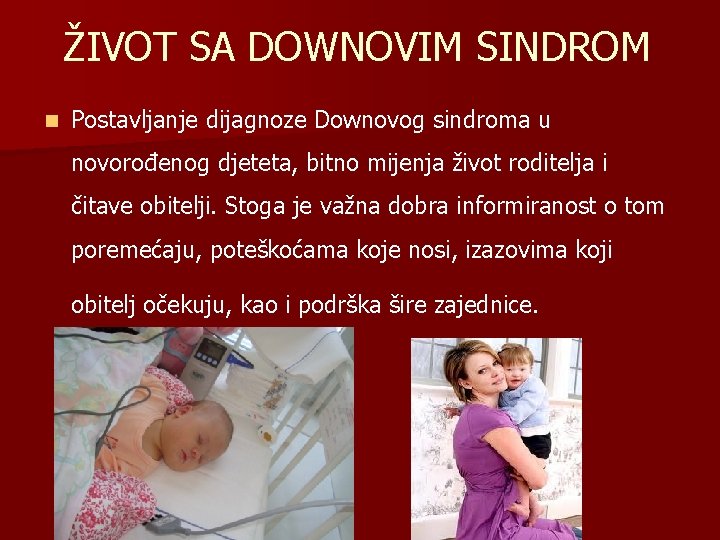 ŽIVOT SA DOWNOVIM SINDROM n Postavljanje dijagnoze Downovog sindroma u novorođenog djeteta, bitno mijenja