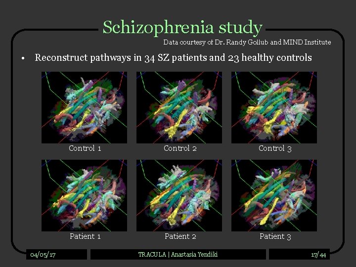 Schizophrenia study Data courtesy of Dr. Randy Gollub and MIND Institute • Reconstruct pathways