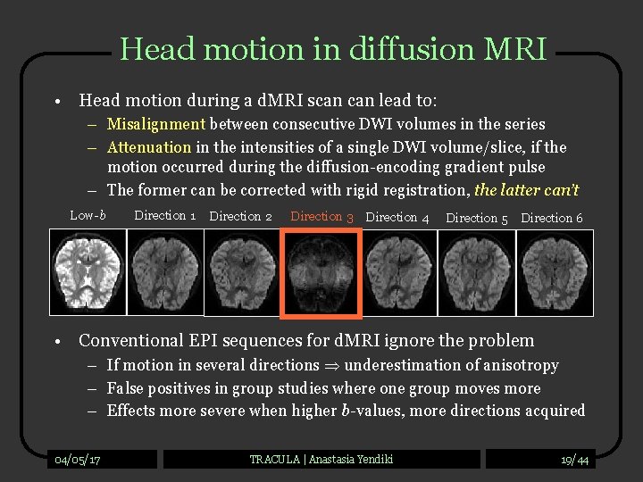 Head motion in diffusion MRI • Head motion during a d. MRI scan lead