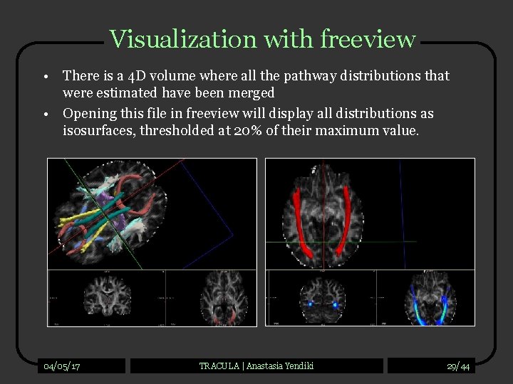 Visualization with freeview • There is a 4 D volume where all the pathway