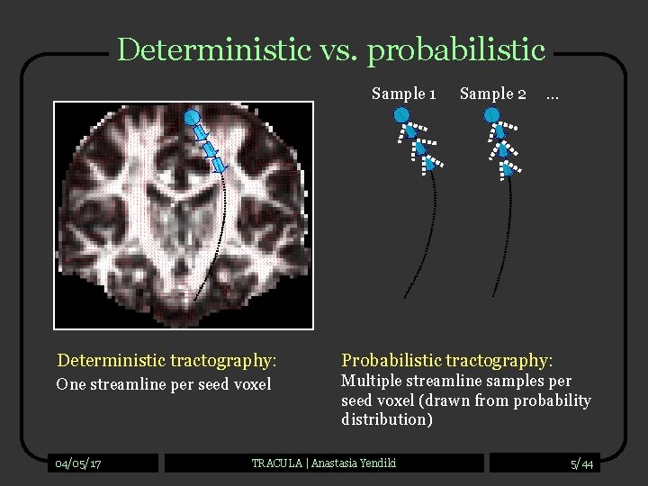 Deterministic vs. probabilistic Sample 1 Sample 2 … Deterministic tractography: Probabilistic tractography: One streamline