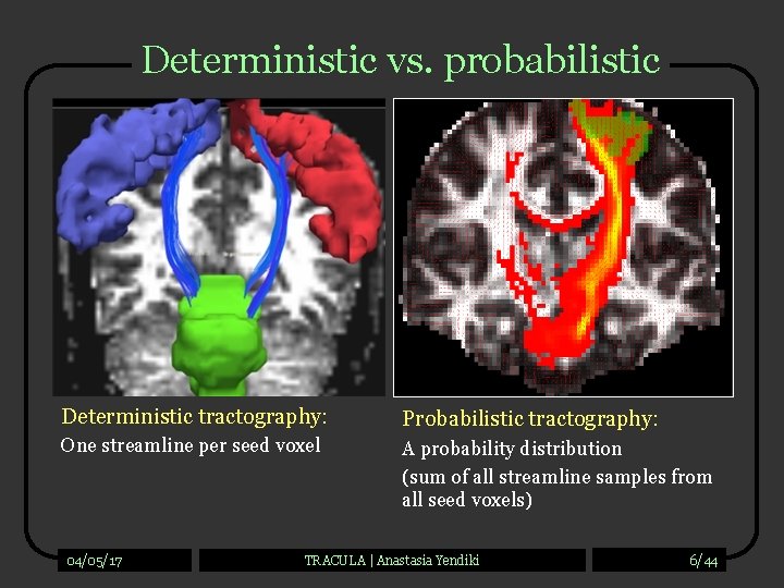 Deterministic vs. probabilistic Deterministic tractography: Probabilistic tractography: One streamline per seed voxel A probability Deterministic vs. probabilistic Deterministic tractography: Probabilistic tractography: One streamline per seed voxel A probability