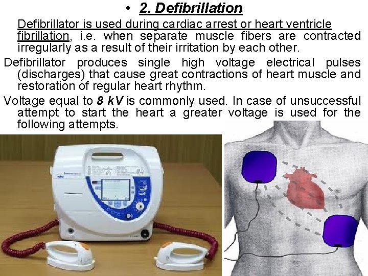  • 2. Defibrillation Defibrillator is used during cardiac arrest or heart ventricle fibrillation,