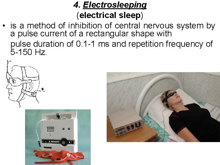 4. Electrosleeping (electrical sleep) • is a method of inhibition of central nervous system