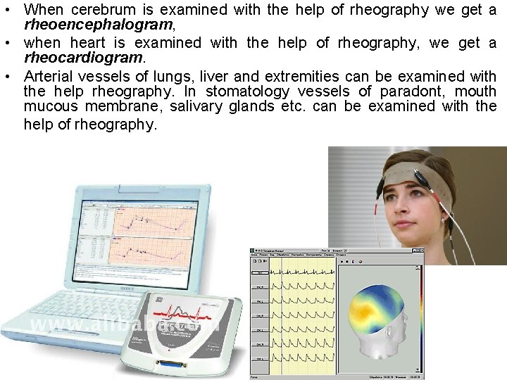  • When cerebrum is examined with the help of rheography we get a