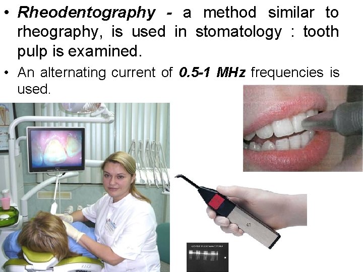  • Rheodentography - a method similar to rheography, is used in stomatology :