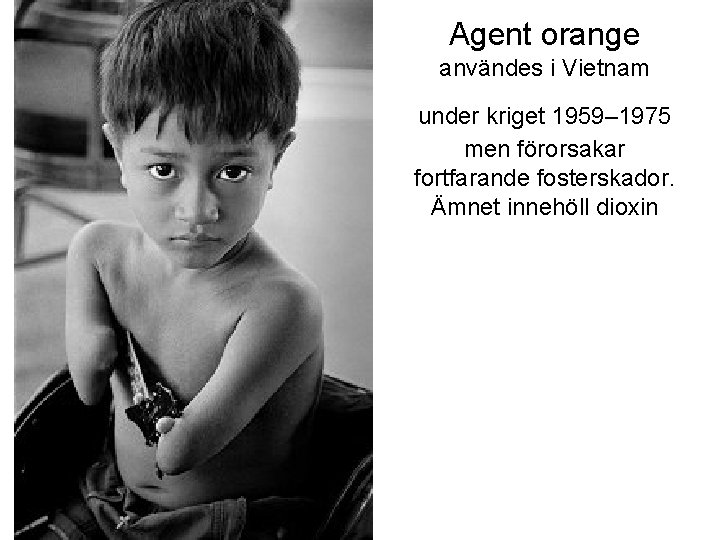 Agent orange användes i Vietnam under kriget 1959– 1975 men förorsakar fortfarande fosterskador. Ämnet