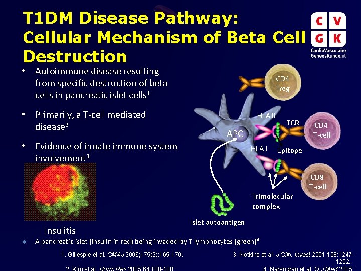 T 1 DM Disease Pathway: Cellular Mechanism of Beta Cell Destruction • Autoimmune disease