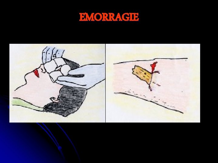 EMORRAGIE 