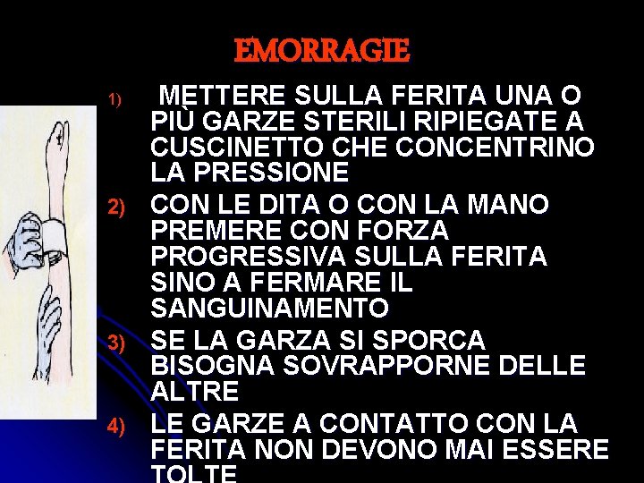 1) 2) 3) 4) EMORRAGIE METTERE SULLA FERITA UNA O PIÙ GARZE STERILI RIPIEGATE