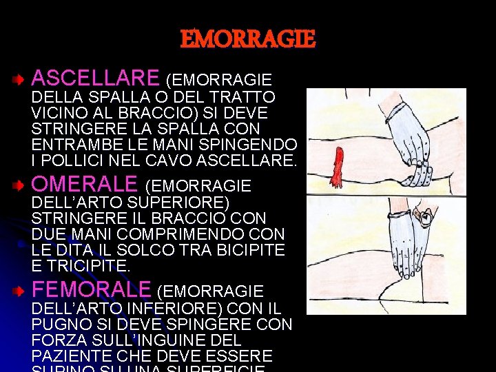 EMORRAGIE ASCELLARE (EMORRAGIE DELLA SPALLA O DEL TRATTO VICINO AL BRACCIO) SI DEVE STRINGERE