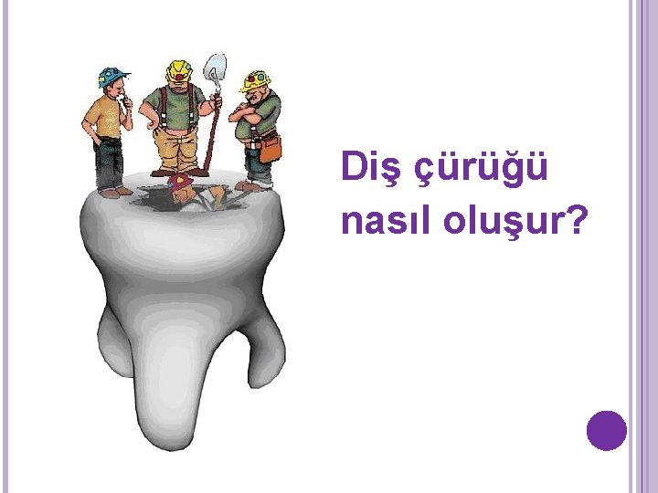 Diş çürüğü nasıl oluşur? Diş çürüğü nasıl oluşur?