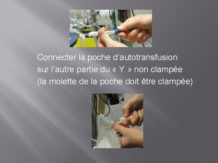 Connecter la poche d’autotransfusion sur l’autre partie du « Y » non clampée (la