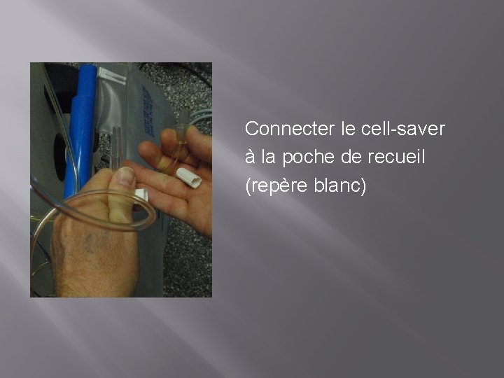 Connecter le cell-saver à la poche de recueil (repère blanc) 