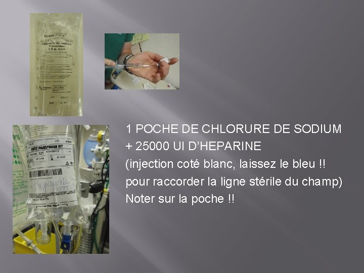 1 POCHE DE CHLORURE DE SODIUM + 25000 UI D’HEPARINE (injection coté blanc, laissez