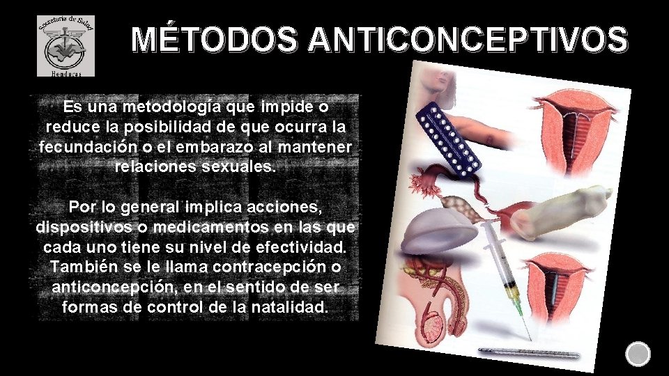 MÉTODOS ANTICONCEPTIVOS Es una metodología que impide o reduce la posibilidad de que ocurra