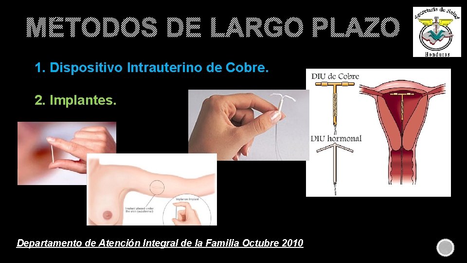 MÉTODOS DE LARGO PLAZO 1. Dispositivo Intrauterino de Cobre. 2. Implantes. Departamento de Atención