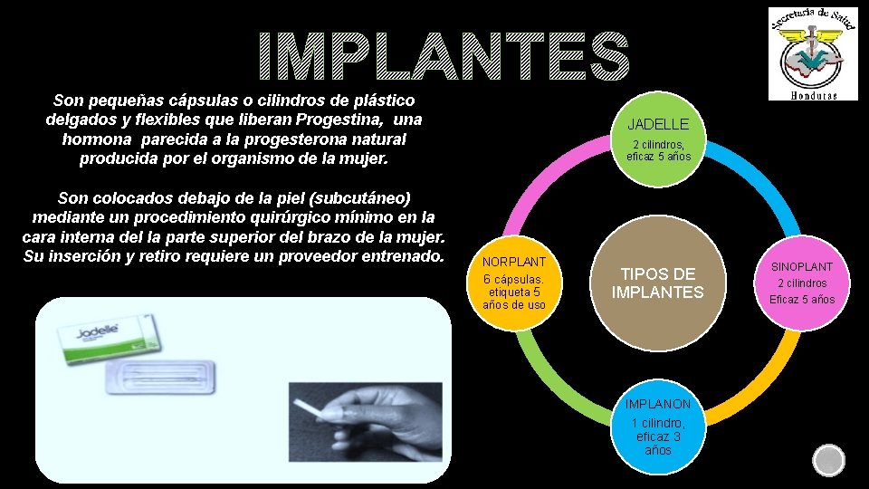 IMPLANTES Son pequeñas cápsulas o cilindros de plástico delgados y flexibles que liberan Progestina,