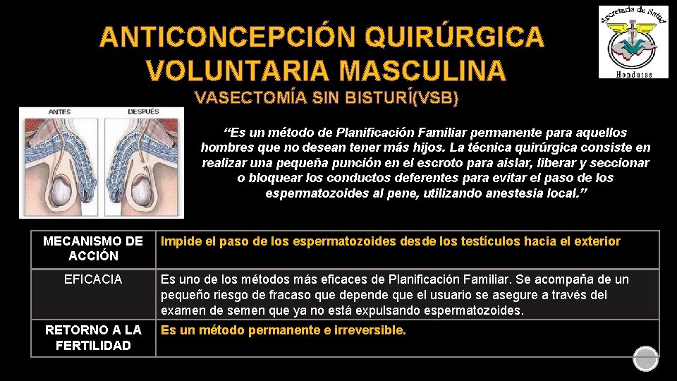 ANTICONCEPCIÓN QUIRÚRGICA VOLUNTARIA MASCULINA VASECTOMÍA SIN BISTURÍ(VSB) “Es un método de Planificación Familiar permanente